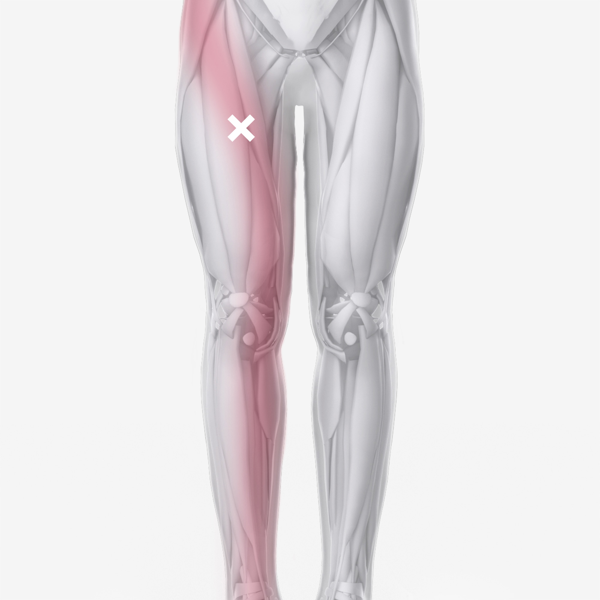Adductor Brevis