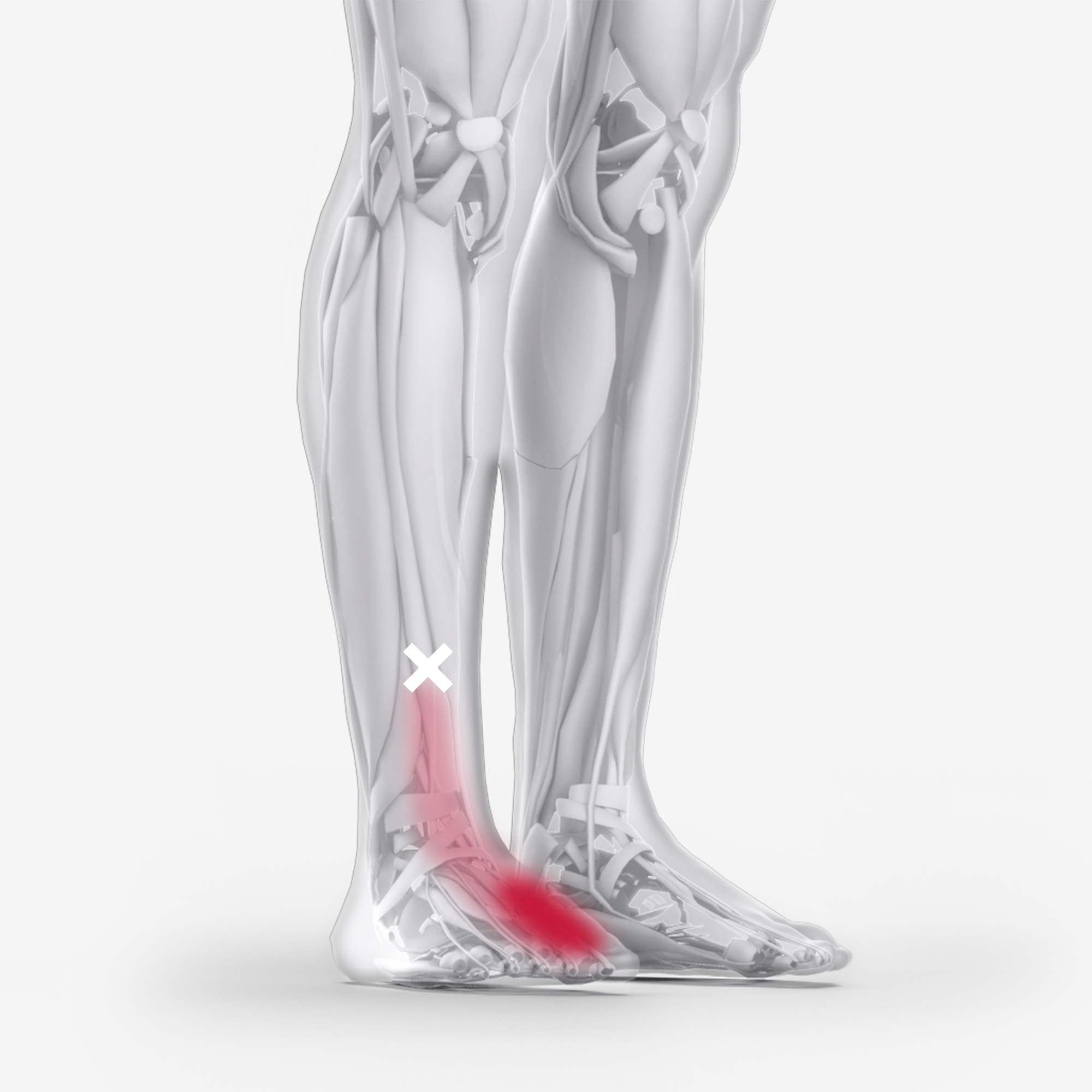 Extensor Hallucis Longus