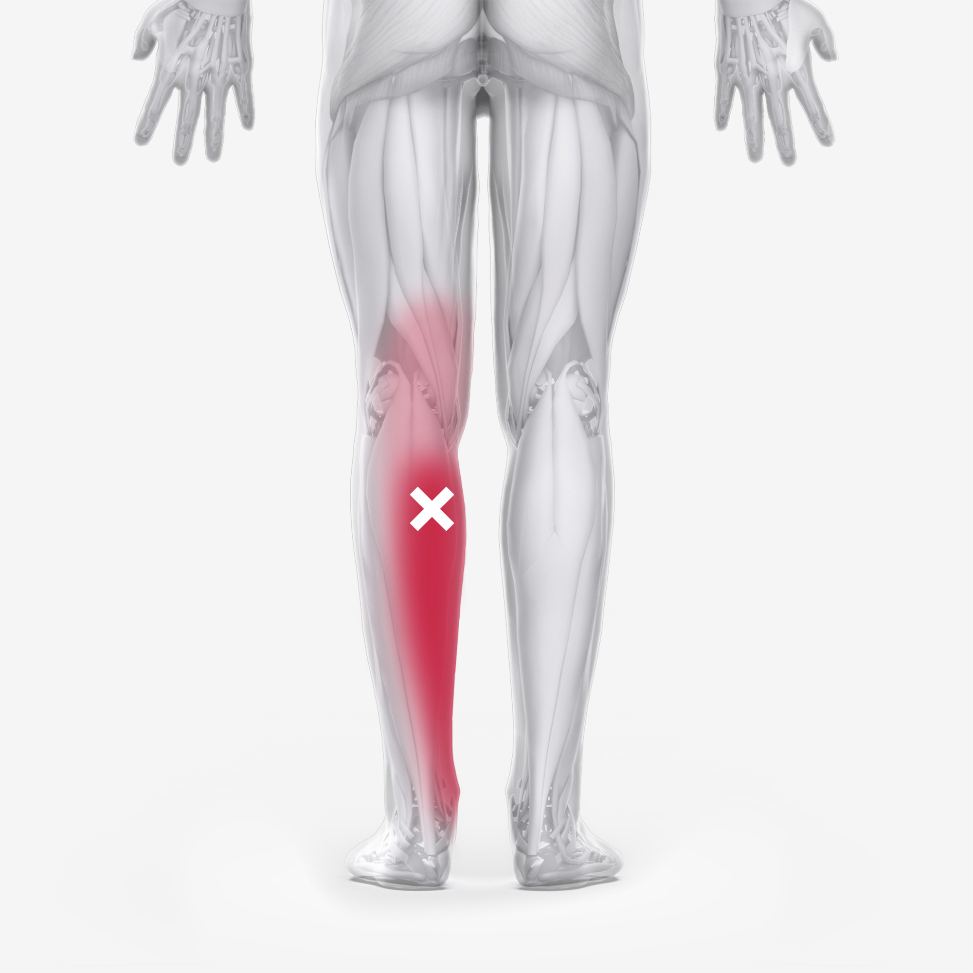 Gastrocnemius