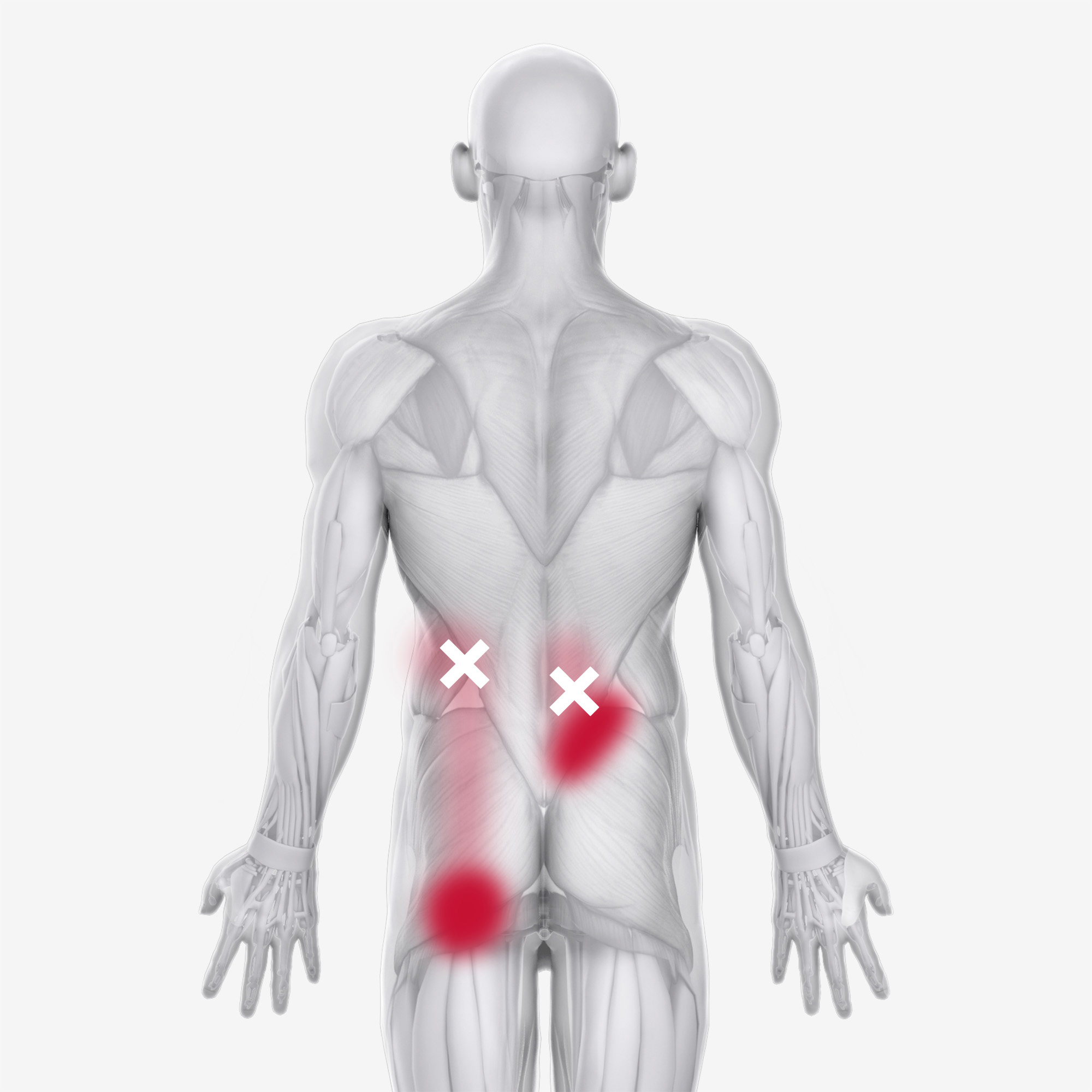 Iliocostalis Lumborum