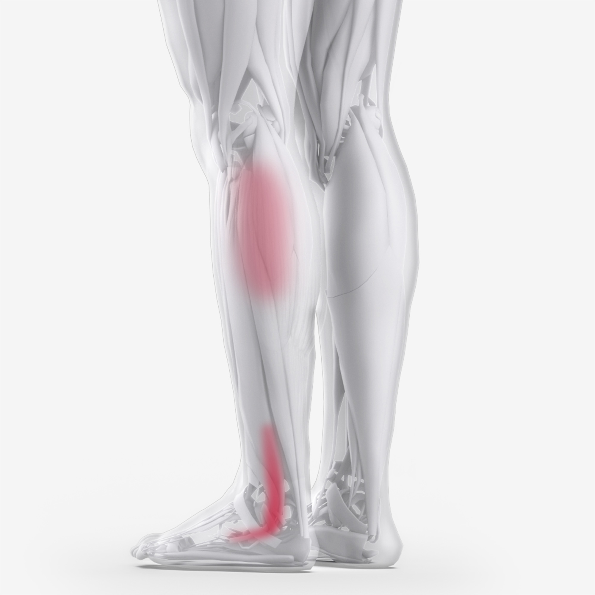 Peroneus Brevis Longus