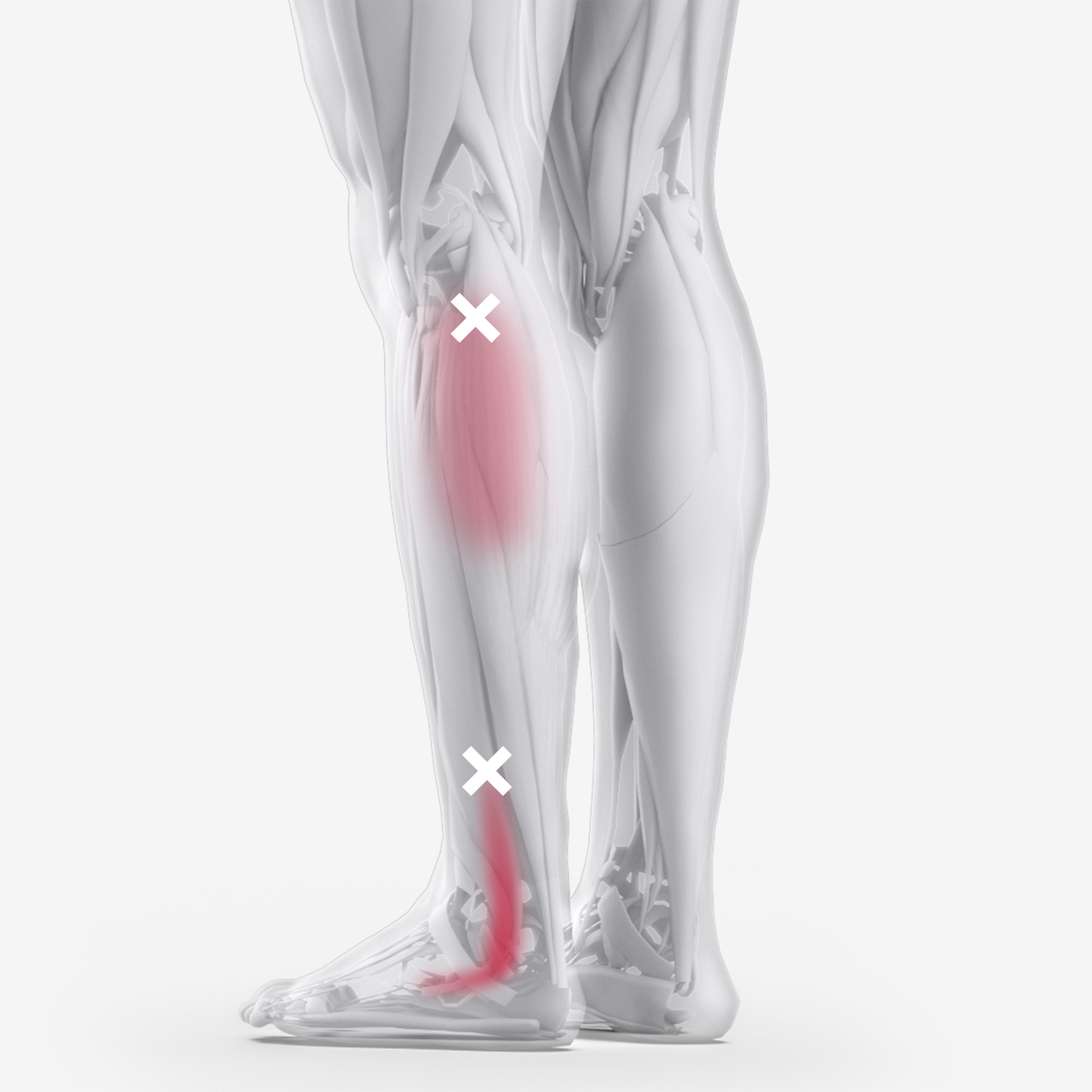 Peroneus Brevis Longus