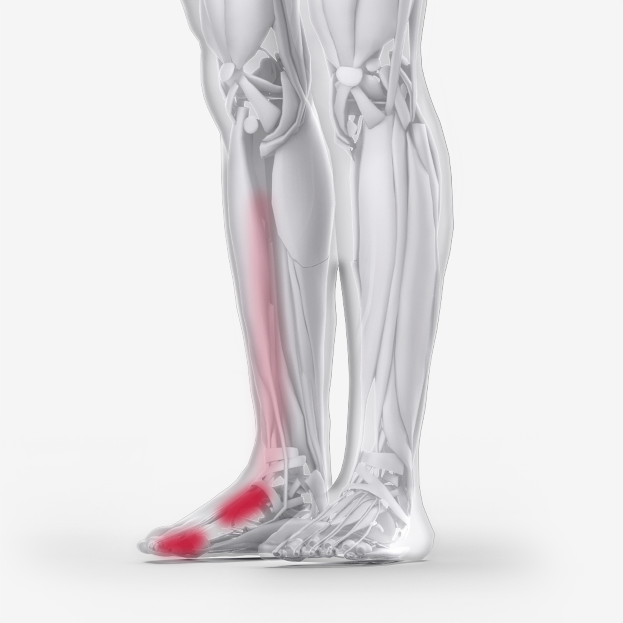 Tibialis Anterior