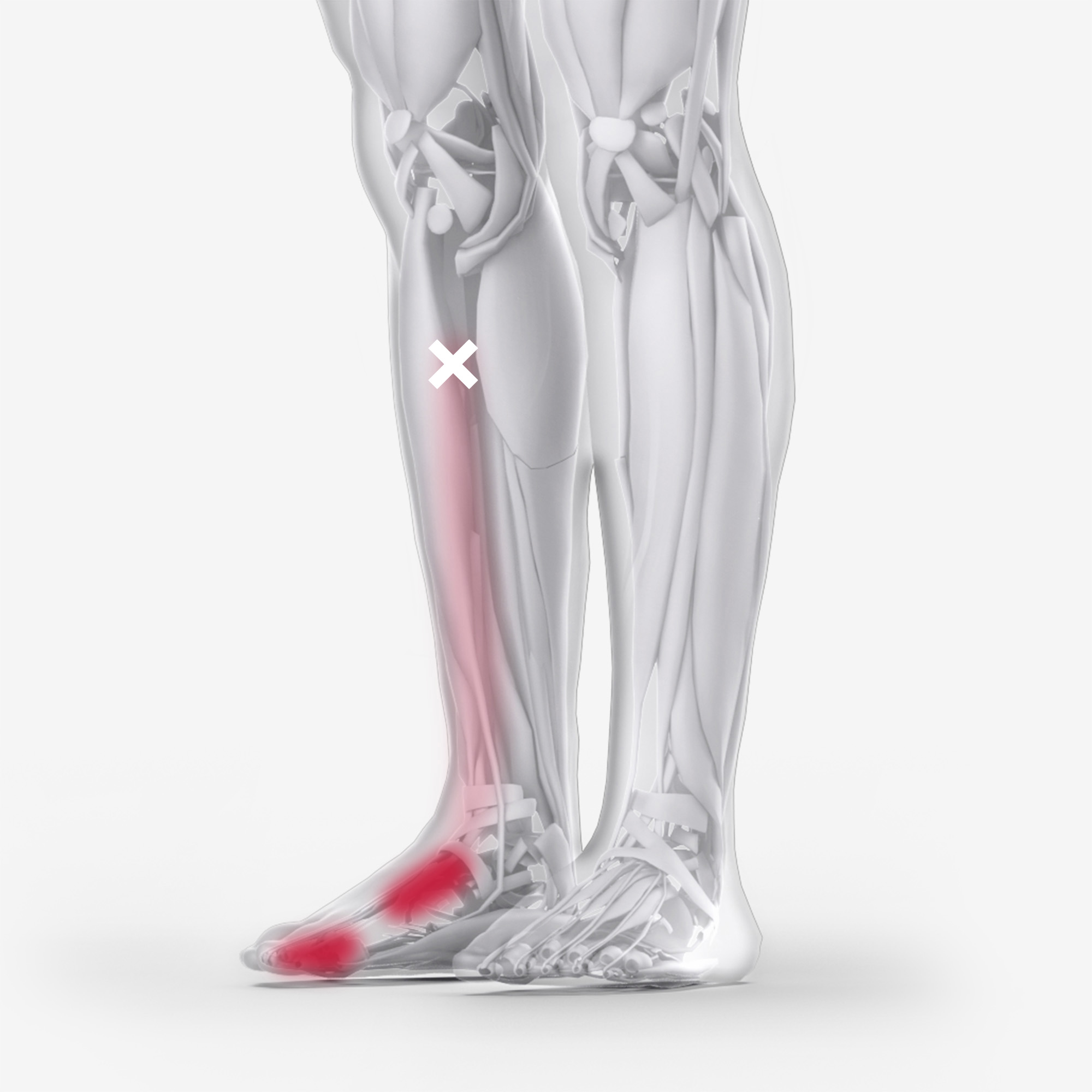 Tibialis Anterior