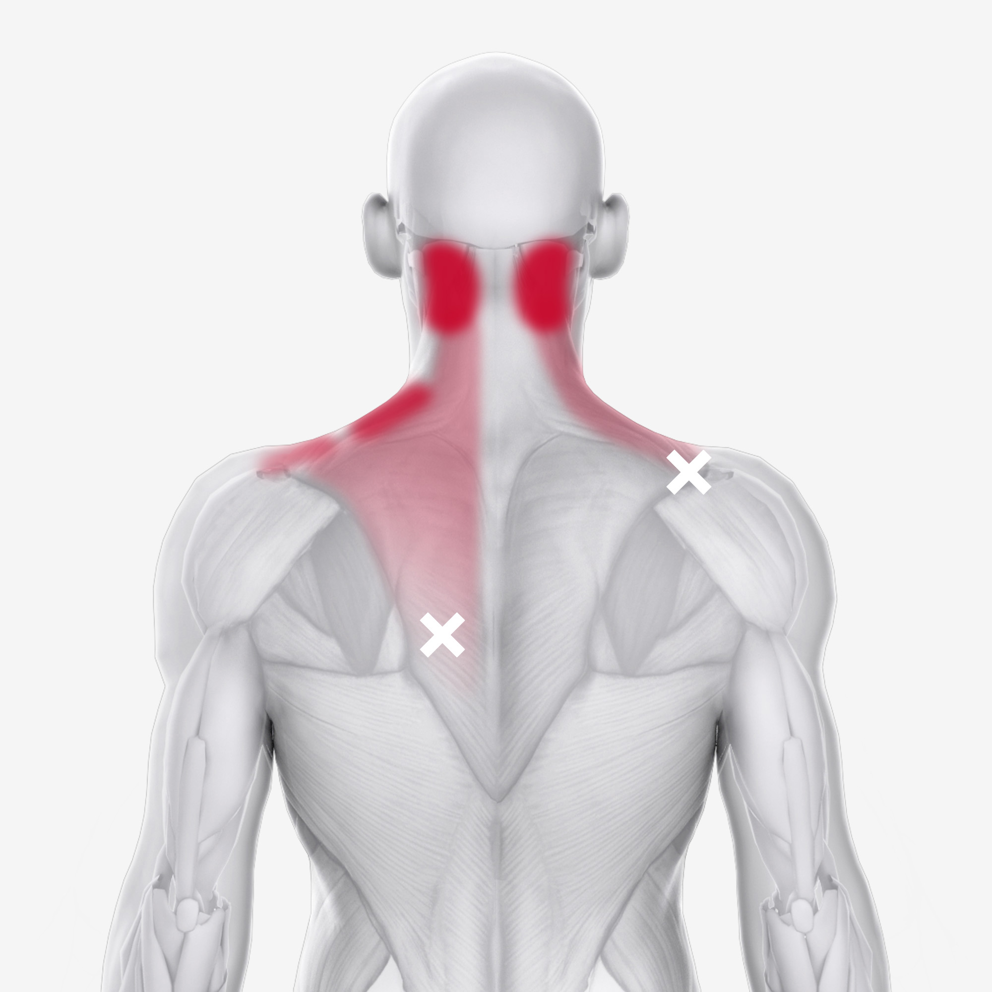 Trapezius